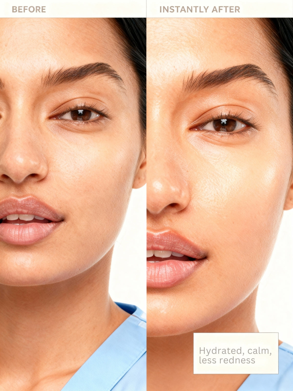 Before and after comparison of a woman's face with text indicating hydration, calmness, and reduced redness.