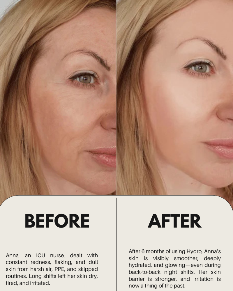Before and after results using Hydro moisturizer — reduced redness and smoother skin