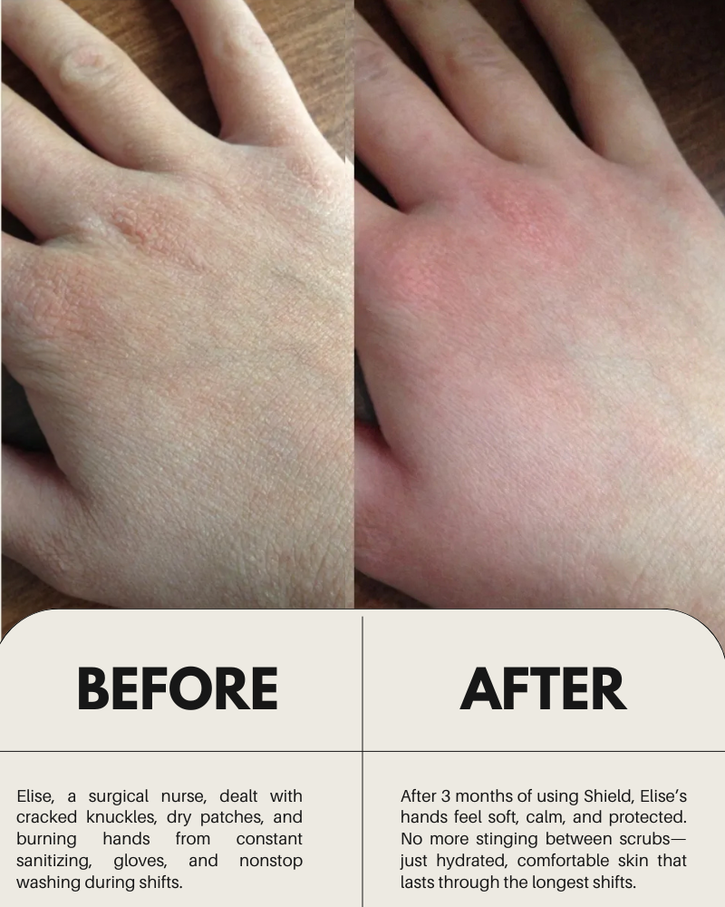 Healthcare worker applying ShiftGlow Shield hand cream during shift