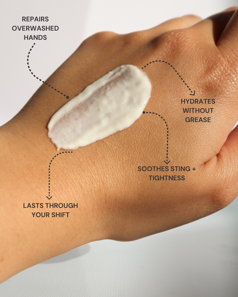 Before and after using Shield hand cream — visible improvement in dry, cracked hands