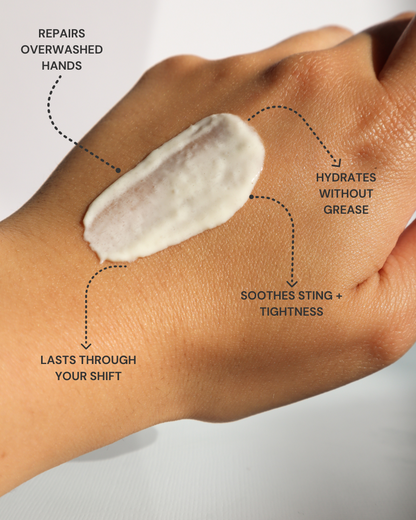 Before and after using Shield hand cream — visible improvement in dry, cracked hands